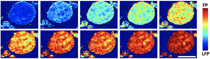 Lithium's Narrow Paths Limit Batteries